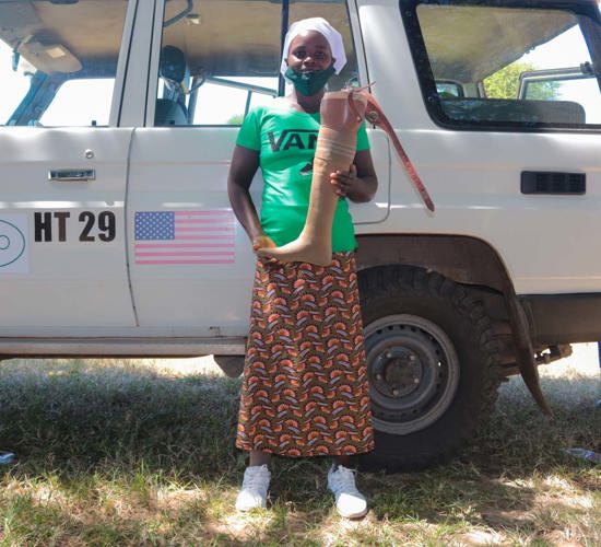 Patience holds her prosthetic leg from the Cassim clinic in front of a HALO vehicle